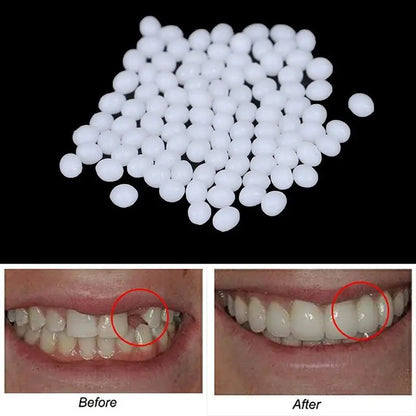 Temporary Tooth Repair Kit Teeth And Gaps FalseTeeth Solid Glue Denture Adhesive Teeth Whitening Tooth Beauty Tool 20g