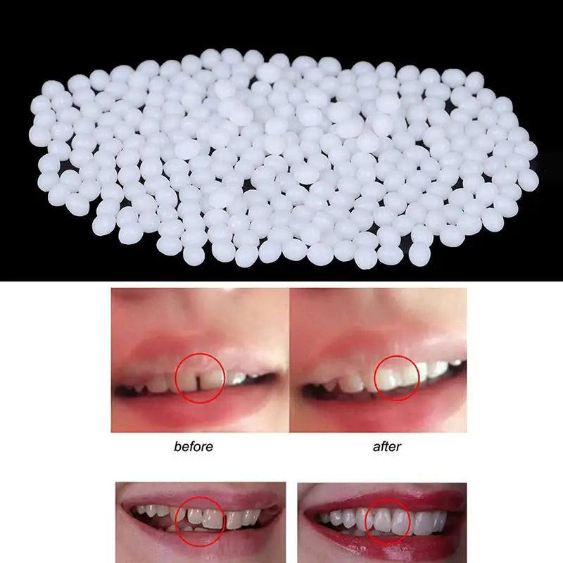 Kit de reparación dental temporal, dientes y huecos, pegamento sólido, adhesivo para dentadura postiza, blanqueamiento dental, herramienta de belleza dental, 20g